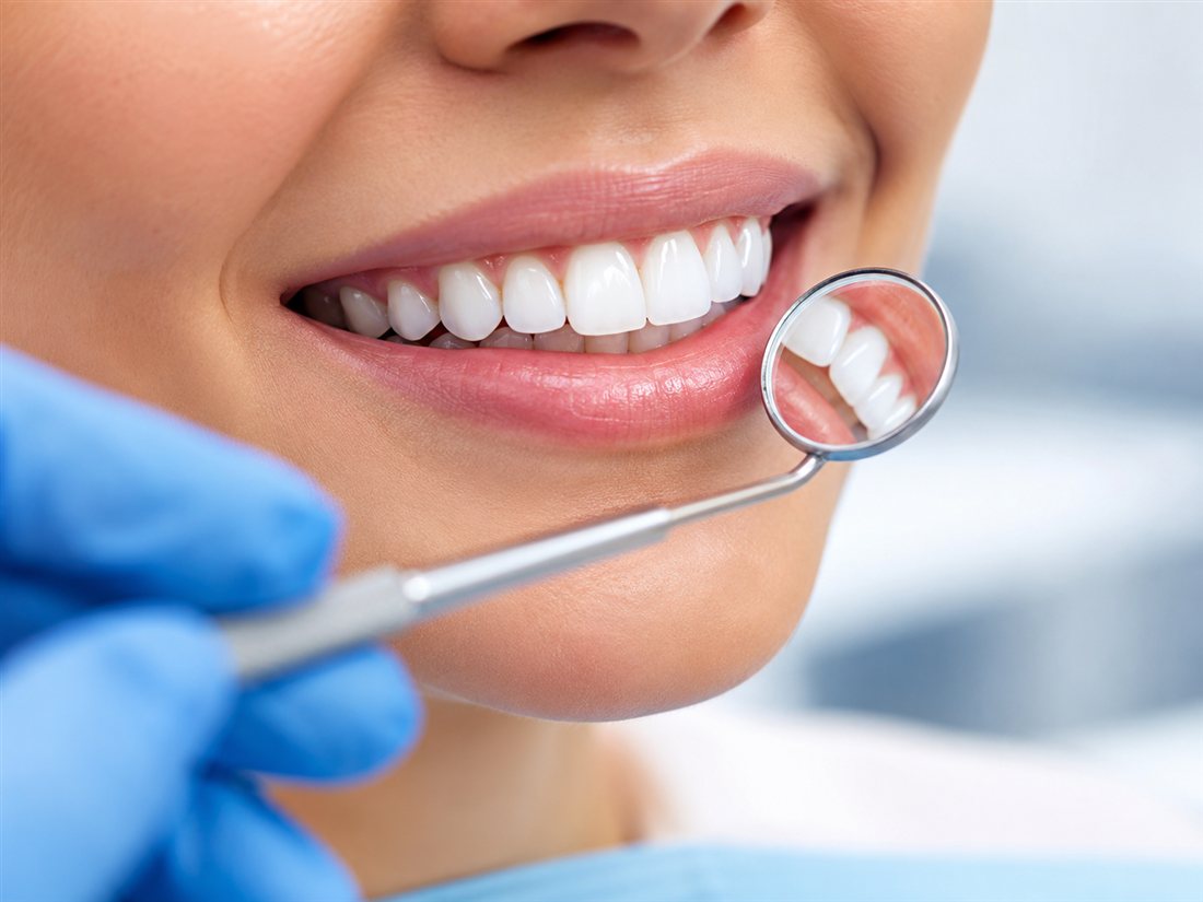 Close-up of a woman's healthy smile during a dental check, with a dentist's mirror
